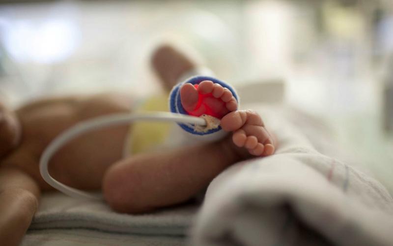 CHRISTUS St. Elizabeth has a Level 3 Neonatal ICU